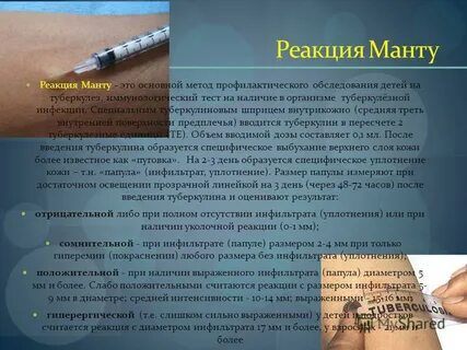 После орви можно делать манту