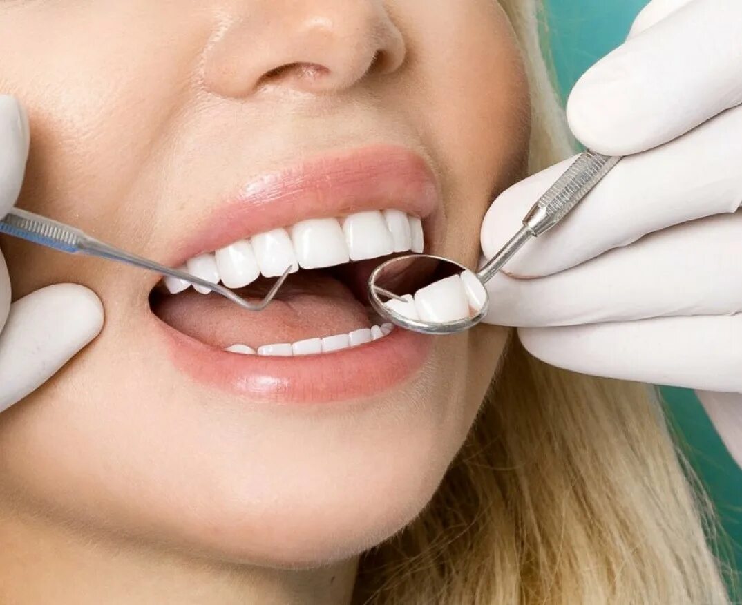 Лечение полости рта и зубов. Красивые зубы. Зубы стоматолог. Эстетическая стоматология. Профессиональная гигиена полости рта и зубов.