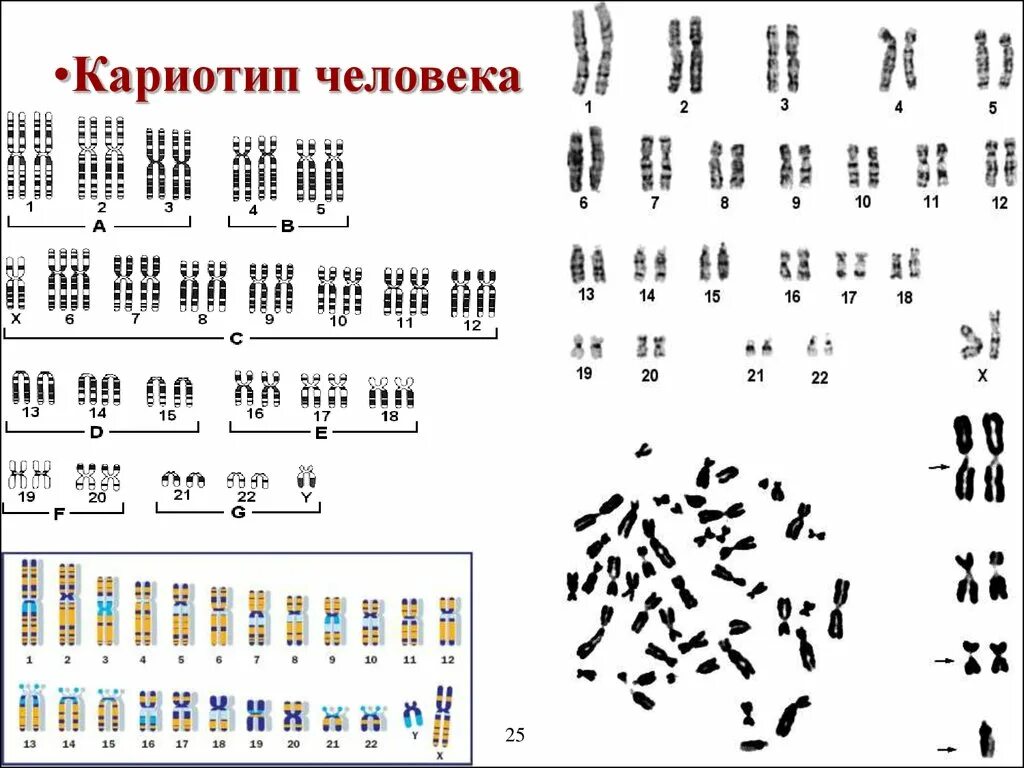 Кариотип человека определяют