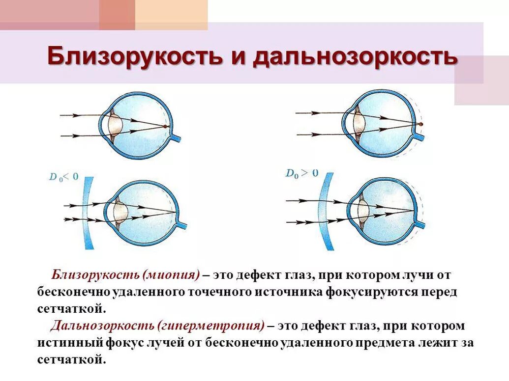 Как понять минус зрения. Зрение близорукость и дальнозоркость. таблица нарушение зрения близорукость дальнозоркость. линзы для близорукости и дальнозоркости физика. близорукость и дальнозоркость за сетчаткой.