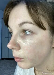 Сухая кожа лица отзывы