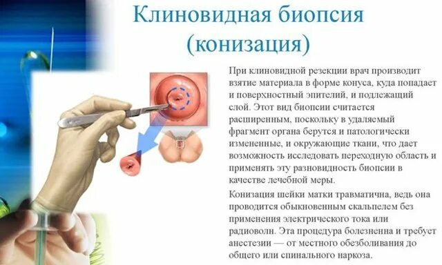 Секс После Биопсии