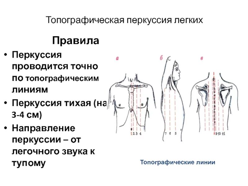 Топографическая перкуссия легких алгоритм. Перкуссия грудной клетки пропедевтика. Порядок топографической перкуссии легких. Алгоритм проведения перкуссии. Топографические границы легких