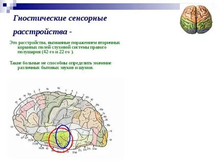 Сенсорные нарушения зрительной системы
