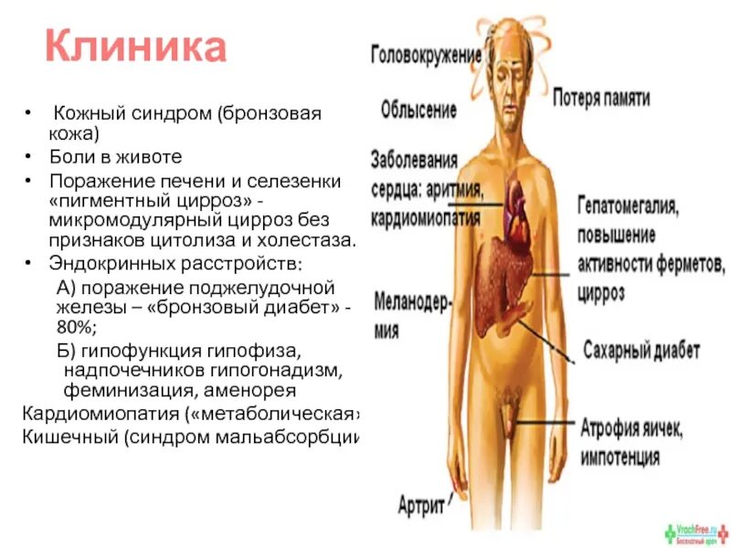 Гепатомегалия поджелудочной железы что это. Гепатомегалия диффузные изменения поджелудочной железы. гепатомегалии диффузных изменений печени. гепатомегалия симптомы. гепатомегалия классификация.