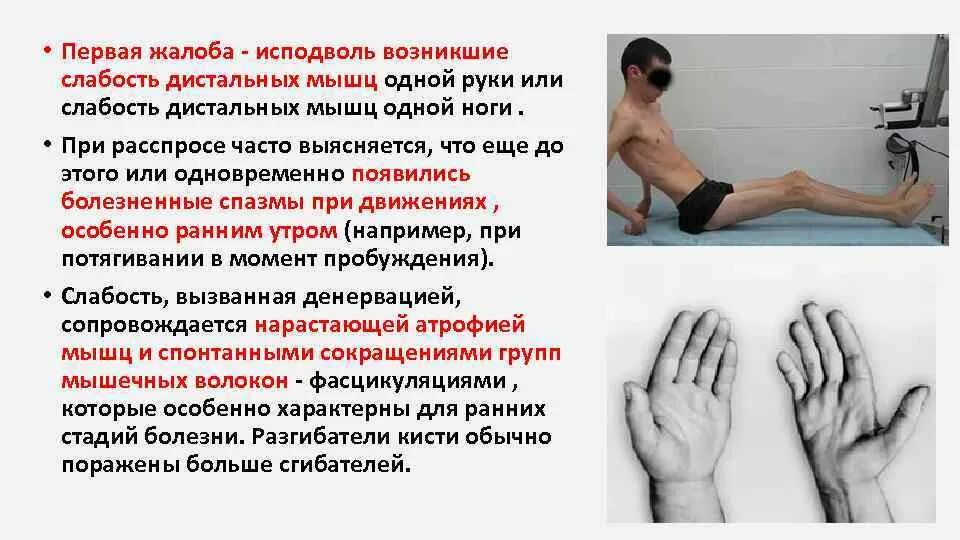 Напряжение в руке и ноге