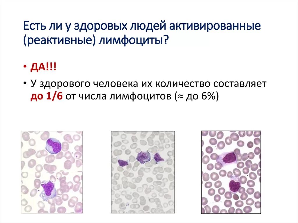 Реактивные лимфоциты в крови