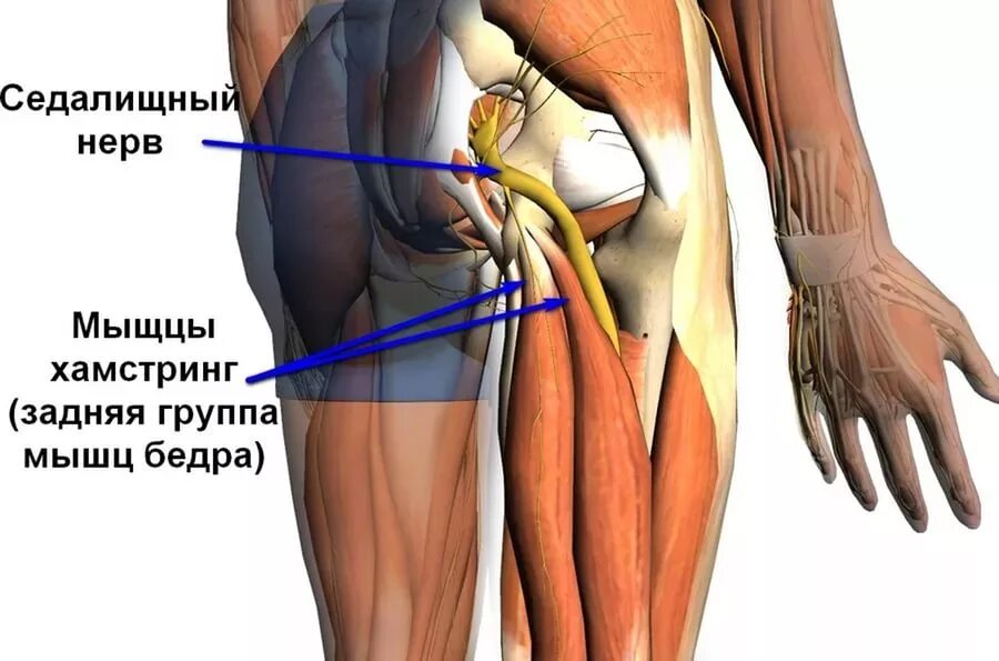 Отрыв сухожилий от седалищного бугра. Седалищный и бедренный нерв. Седалищный нерв в области бедра. Седалищный нерв анатомия мышцы.