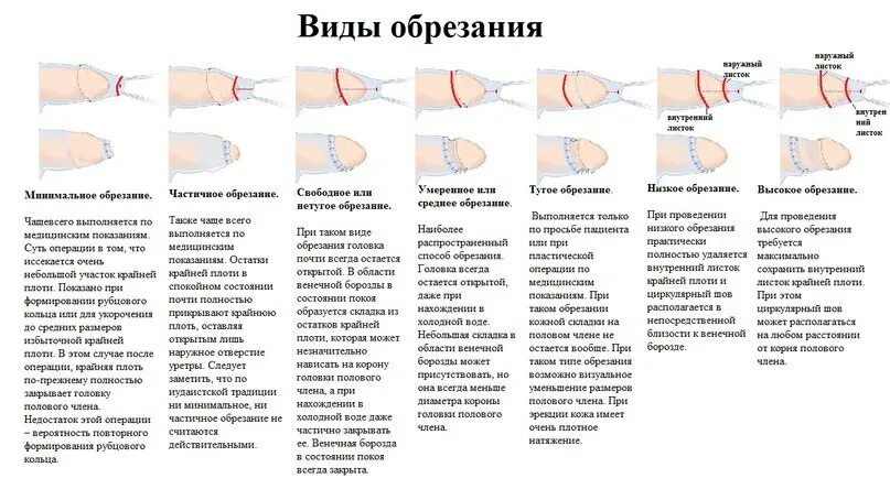 Тип Полового Члена
