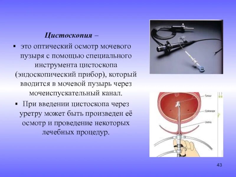Как называется уретра