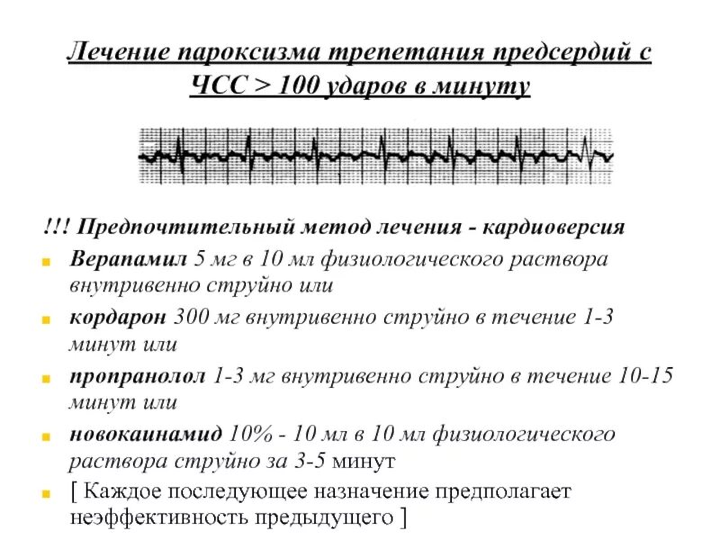 Пароксизмальная тахикардия мерцательная аритмия