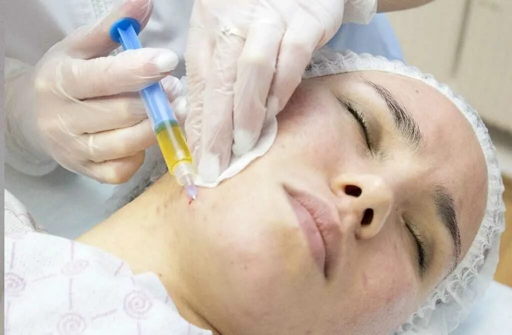Плазмолифтинг prp терапия. Плазмолифтинг для лица. Холодная плазма для лица аппарат. Аппаратная блефаропластика холодная плазма. Prp-терапия плазмотерапия.