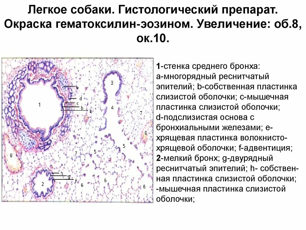 Строение бронхов гистология препарат. Бронхи гистология препарат. Средний бронх гистология препарат. Окрашивание препаратов гематоксилином-эозином.