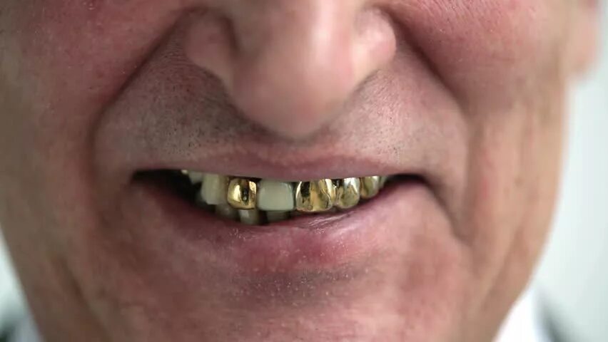 Почему зубы золотые. Почему зубы золотые