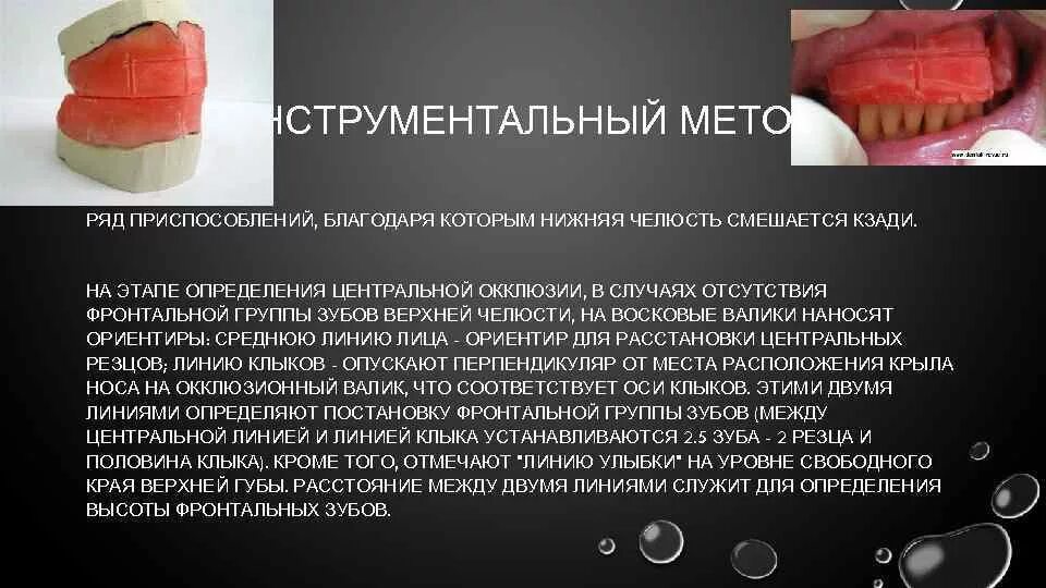 Этапы определения центрального соотношения челюстей. Определение центральной окклюзии. способы определения центральной окклюзии. методика определения центральной окклюзии. инструментальный метод определения центральной окклюзии.