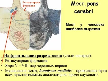 Черепные ядра моста