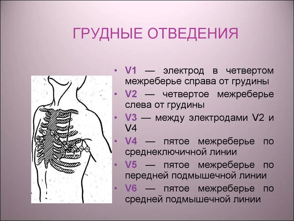 Четвертое межреберье слева. Грудные отведения. Электроды грудных отведений. 5 Межреберье. Правые грудные отведения