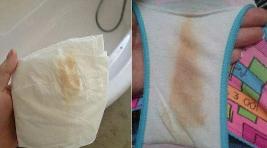 Месячные ощущение форум