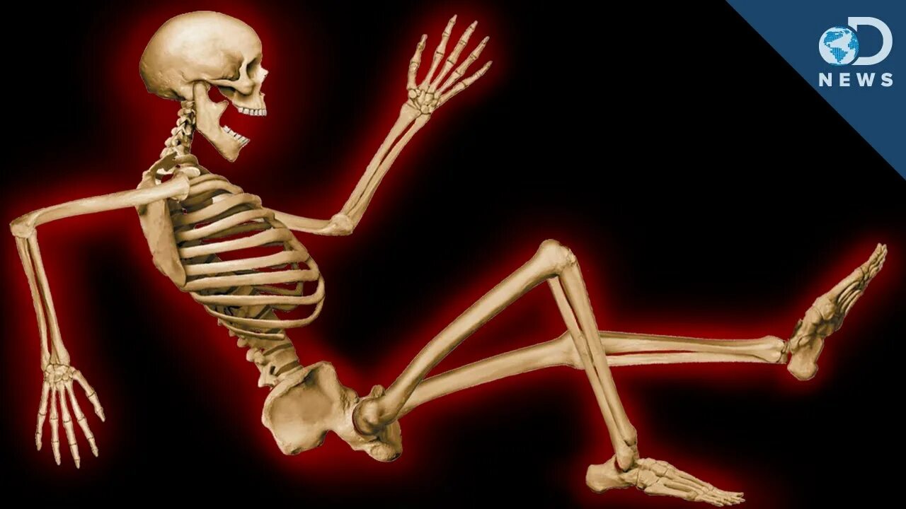 Скелет человека с переломанной костью.