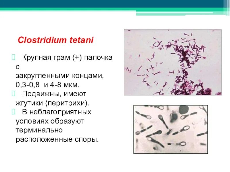 Clostridium perfringens микробиология. Clostridium tetani окраска. Клостридиум тетани по Граму.