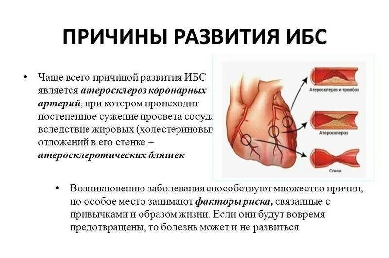 Какие симптомы ишемии. Ишемическая болезнь сердца симптомы причины. клинические проявления ишемической болезни сердца. основные признаки ишемической болезни сердца.