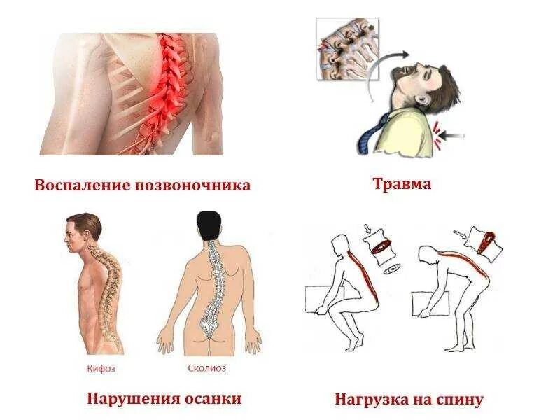 Чем лечить гемангиому позвоночника у взрослых. Чем лечить гемангиому позвоночника у взрослых. Гемангиомы l1 l2 позвонков. Гемангиома позвоночника l1 l2. Гемангиома позвоночника поясничного отдела кт.