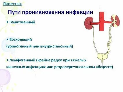 Пути пиелонефрита