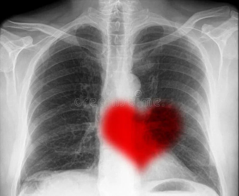 Revolutions: The incredible potential of induced pluripotent stem cells