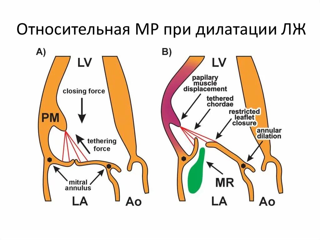 Сегменты лж. Кровоснабжение сегментов лж ЭХОКГ. 17 Сегментов лж.