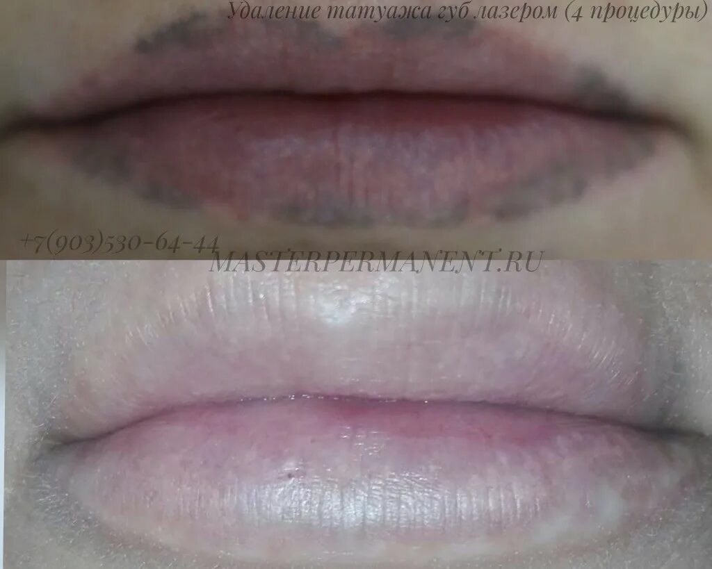 Некачественный татуаж губ. Перманентный макияж губ. Губы после перманентного макияжа. Перманент губ. Перманент губ.