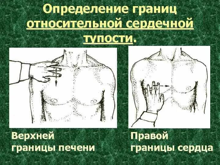 Границы печени. Перкуссия печени верхняя граница. Перкуссия печени верхняя и нижняя границы. Границы печени перкуссия.