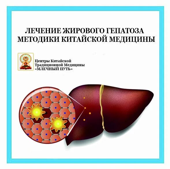 Медицинский центр млечный путь. Селезенка в китайской медицине. Акупрессура печень меридиан. Меридиан печени точки акупунктуры. Китайская медицина печень.