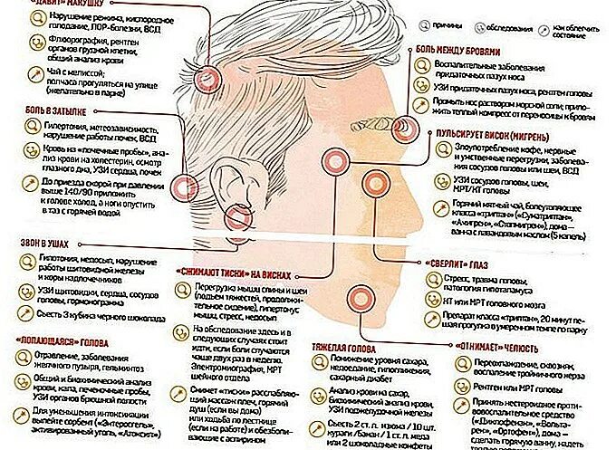 Начинает болеть голова что делать. Болит затылок. Боль в голове. Отчего болит голова. Болит голова причины.