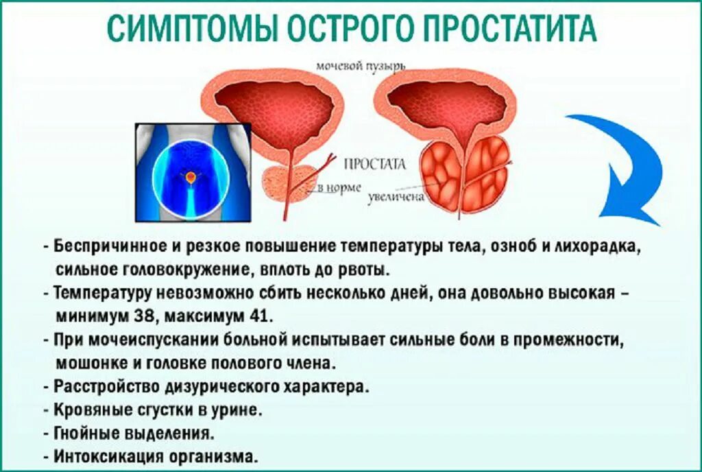 Простата острое