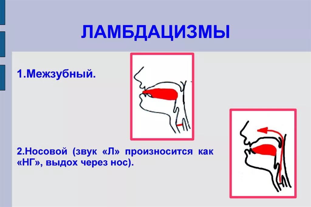 Артикуляция определение. Правильная артикуляция звука л. Нарушения произношения звуков л л. Правильная артикуляция звука л в логопедии. Неправильное произношение звука л.