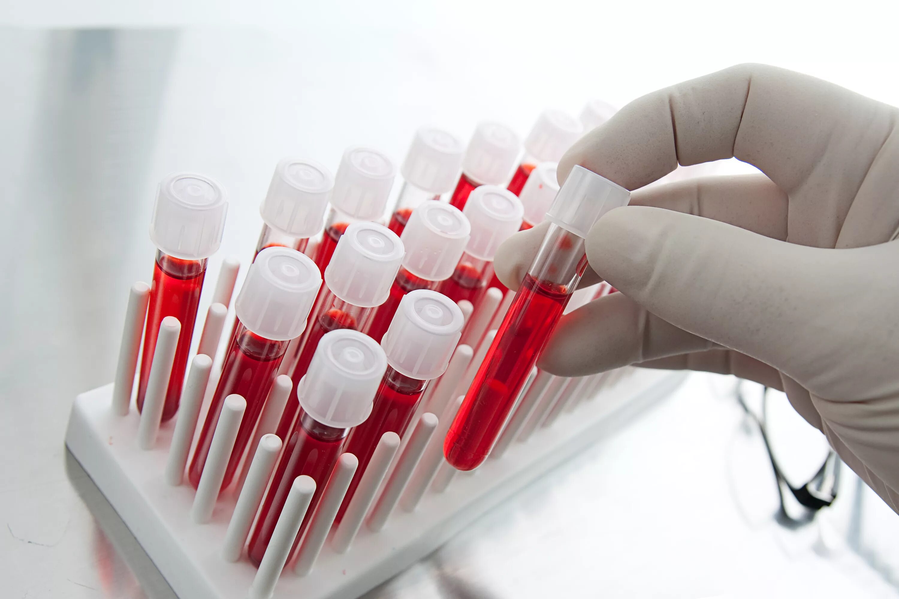 Лабораторные методы вич инфекции. Пробирка для гликированного гемоглобина цвет. Анализ крови. Клиническое исследование крови. Исследование кровли.