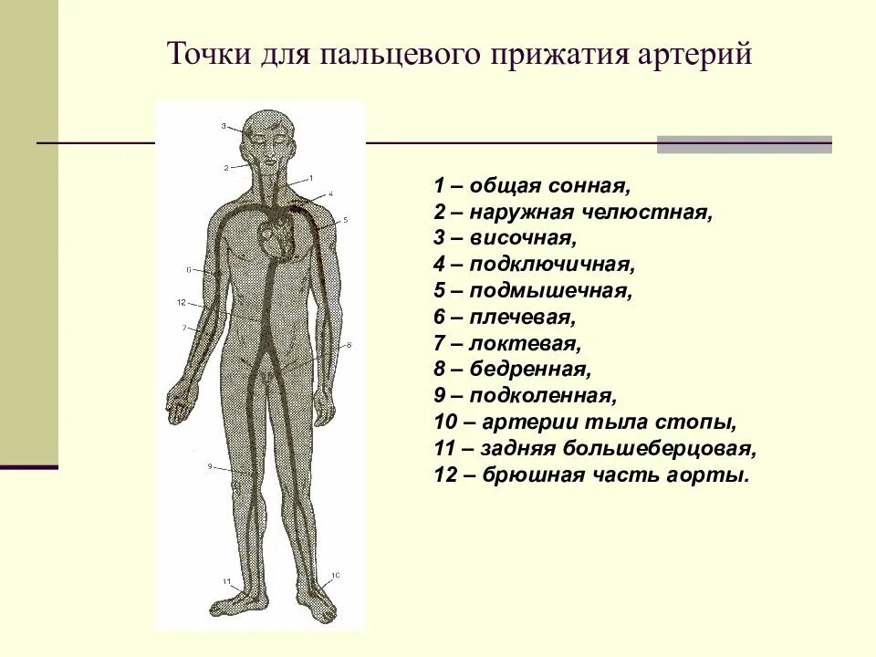 Первая основная точка. Точки пальцевого прижатия. Схема точек пальцевого прижатия. Точки пальцевого прижатия артерий. Точки прижатия артерий схема.