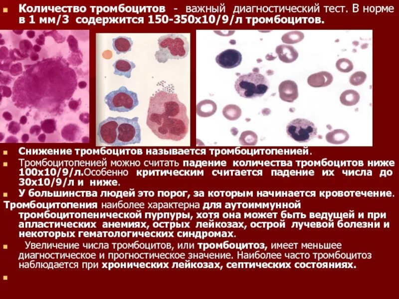 Тромбоцитопении тест. Уменьшение числа тромбоцитов. Снижение количества тромбоцитов. Дегенеративные тромбоциты это. Тромбоциты тромбоцитозы тромбоцитопении.