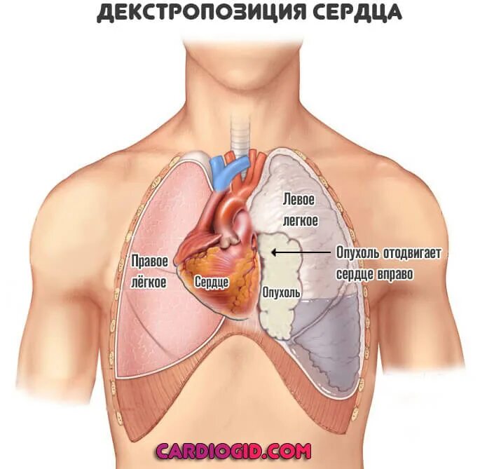 Справа под легким. Где находится сердце у человека. С какойтстороныт серцн. С какой стороны спрдцк.