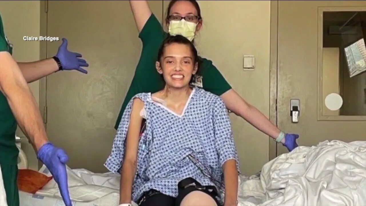 A leg instead of a head. A leg instead of a head. Lost my leg. Lost my leg. Lost my leg.