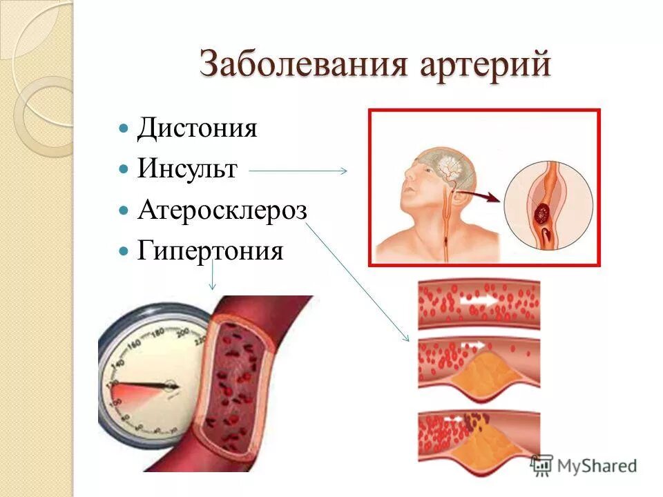 История болезни урок в 8 классе