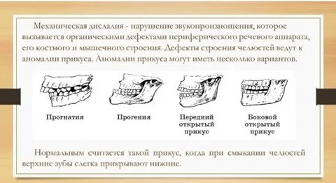 Прикусы виды логопедия
