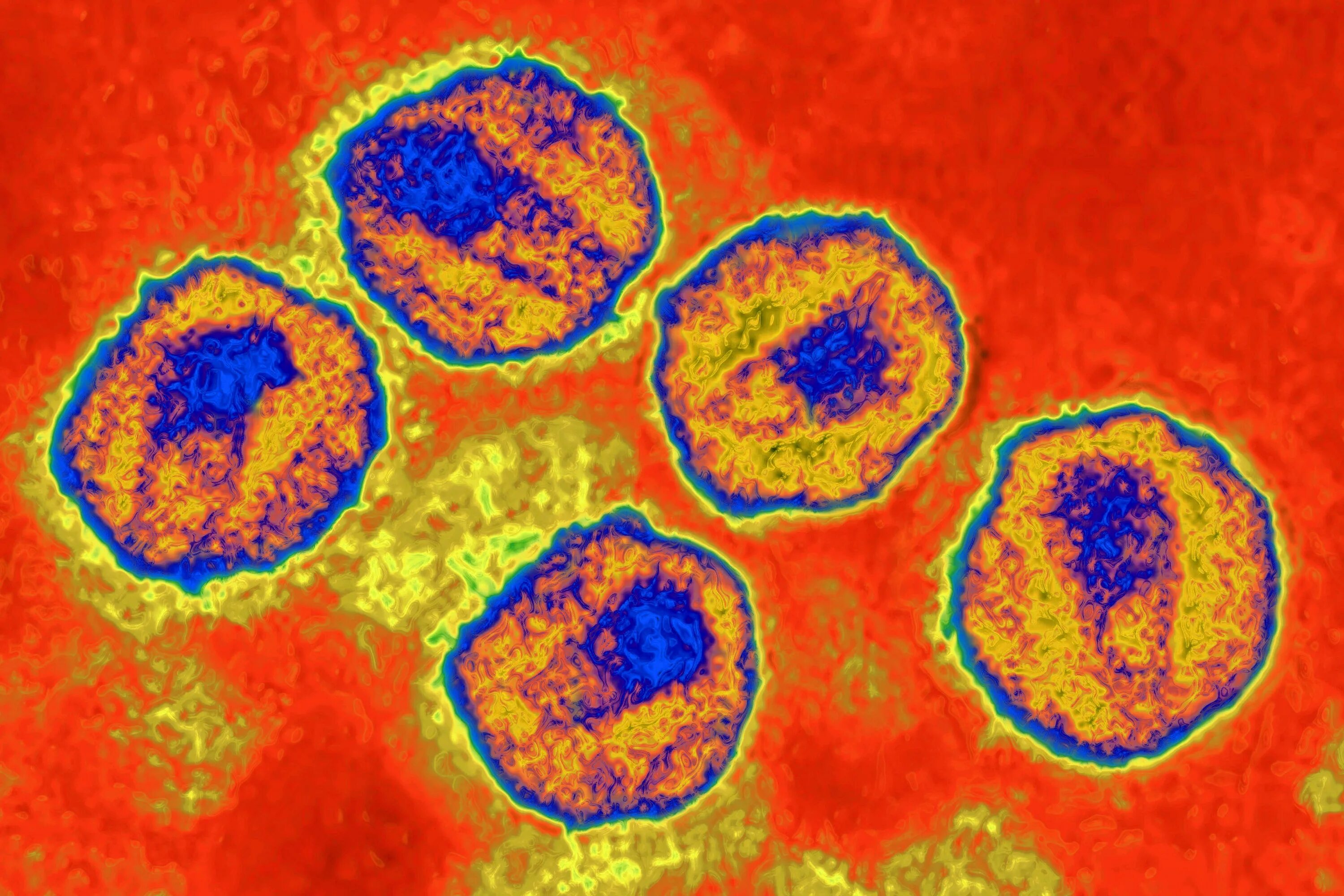 Вирус иммунодефицита человека (Human Immunodeficiency virus). Вирионы ВИЧ под микроскопом. Вирус иммунодефицита под микроскопом. Вирус СПИДА под микроскопом. Human immunodeficiency