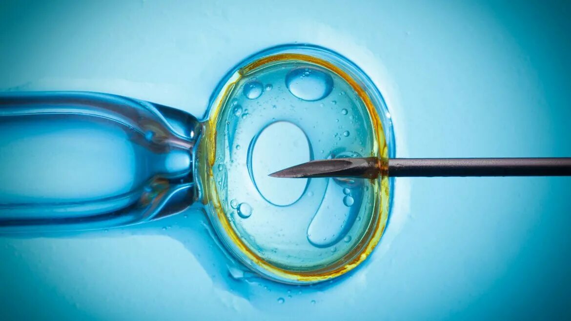 Экстракорпоральное оплодотворение IVF. Эко ИКСИ оплодотворение in vitro. Эко это искусственное оплодотворение. ИКСИ ВРТ.