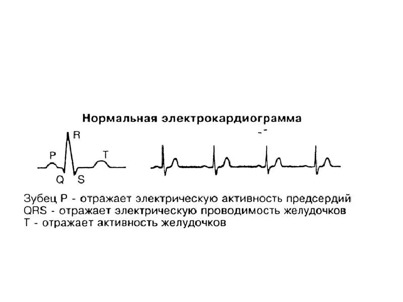 Зубец отражающий электрическую активность предсердий. Электрокардиограмма сердца отражает электрическую активность. Название зубца отражающего электрическую активность желудочков. Зубец отражающий электрическую активность желудочков.
