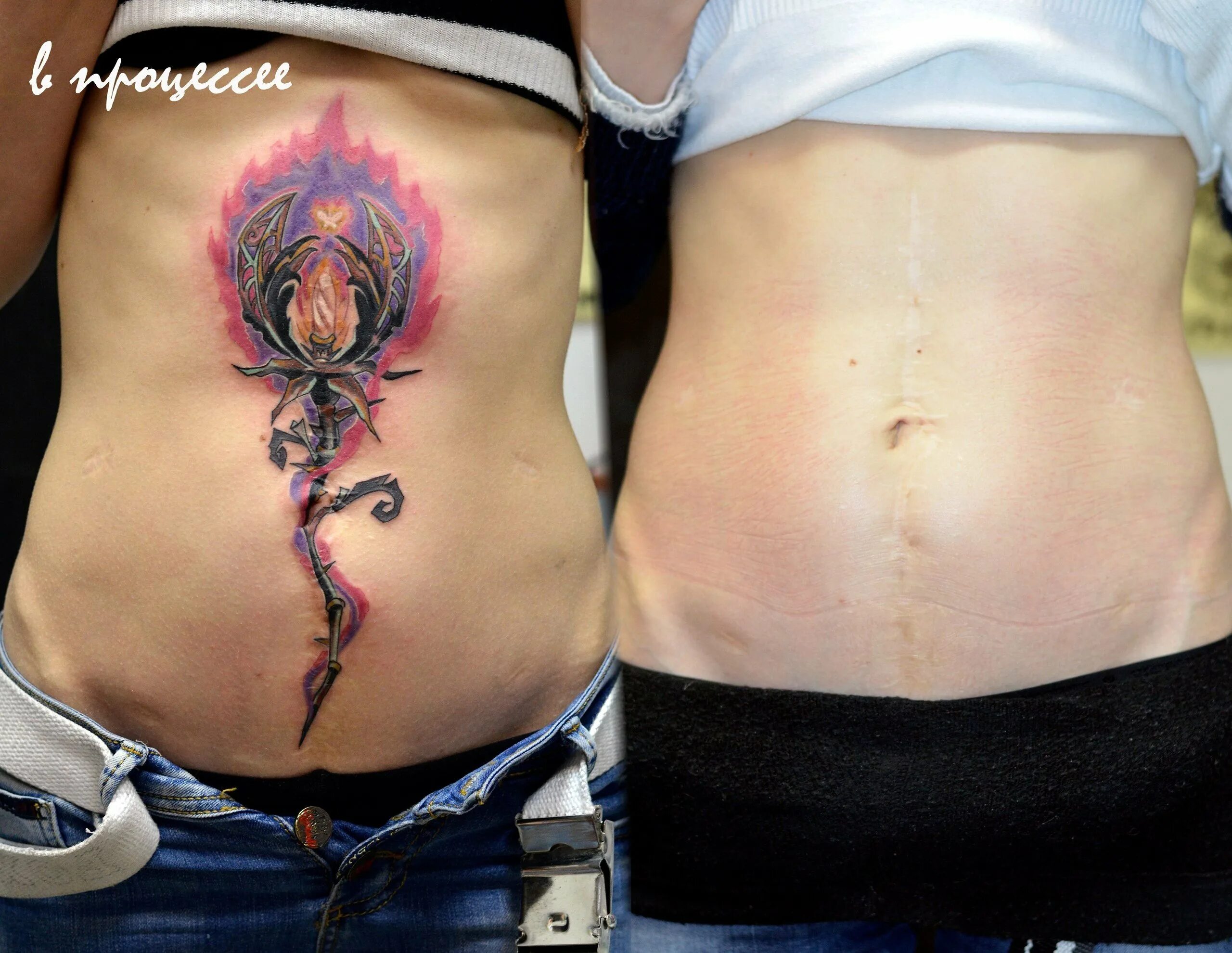 Тату на шрамах на животе у девушек фото. Тату на животе для девушек. Тату на животе для девушек. Тату на животе для девушек на шраме. Тату на животе для девушек.