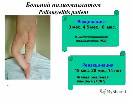 Ножки прививки