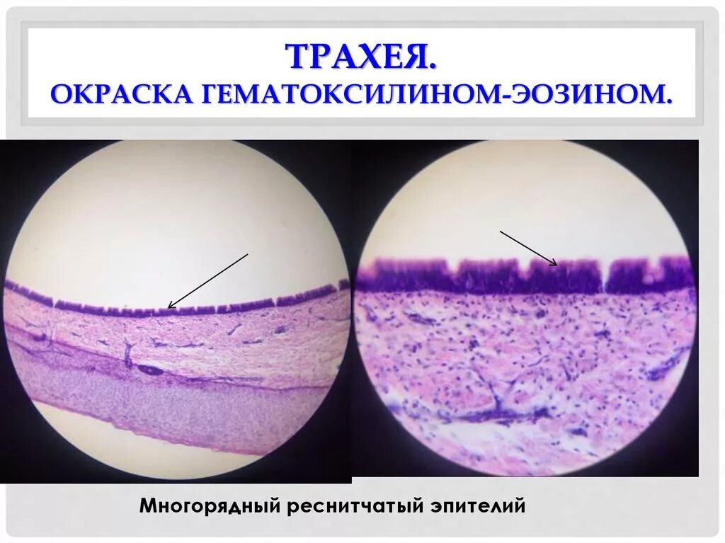 Трахея гистологический. Гематоксилин эозин гистология. многорядный эпителий трахеи гистология. трахея гистология препарат. срез трахеи гистология препарат.