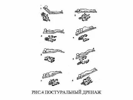 Постуральный дренаж алгоритм