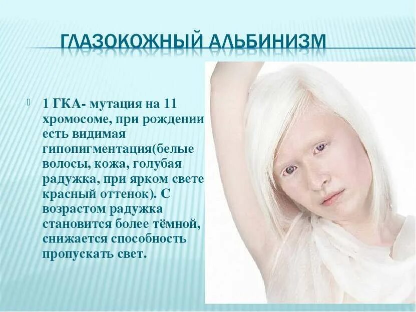 Как называется болезнь когда человек белый. Генетические заболевания альбинизм. Альбинизм тип наследования. Глазно кожный альбинизм 1 типа. Альбинизм генная мутация.